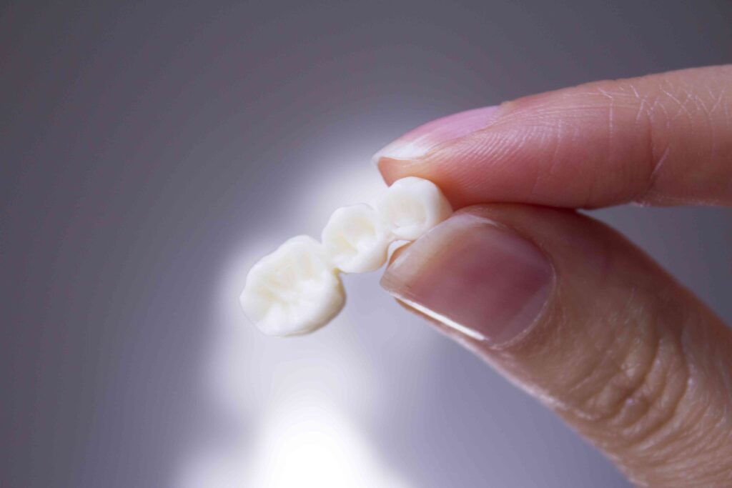 Woman holding a dental bridge